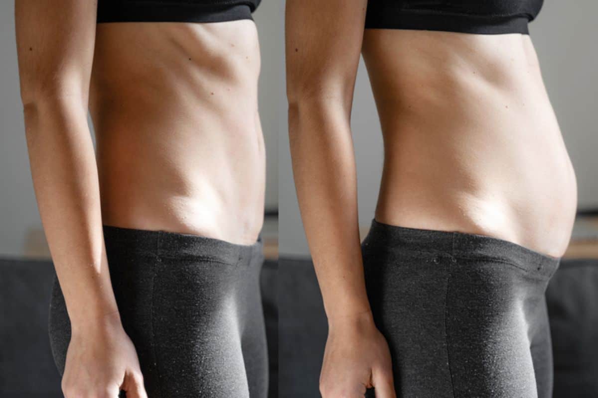 How long does diastasis recti take to improve Fulham?