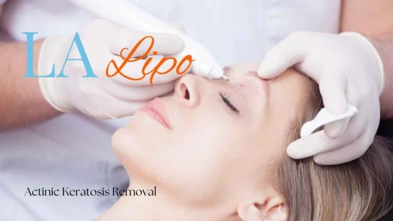 Woman receiving Actinic Keratosis Removal Treatment Fulham