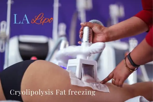 women getting fat freezing Fulham
