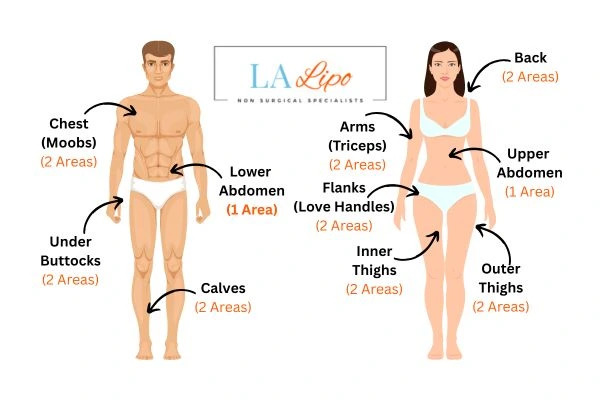 LA LIPO Cryolipolysis Areas Fulham