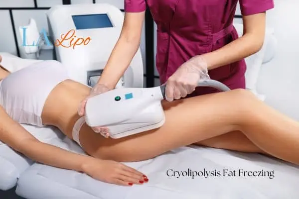 Woman receiving coolsculpting Fulham treatment on her thighs