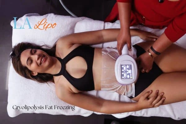 woman getting cryolipolysis Fulham