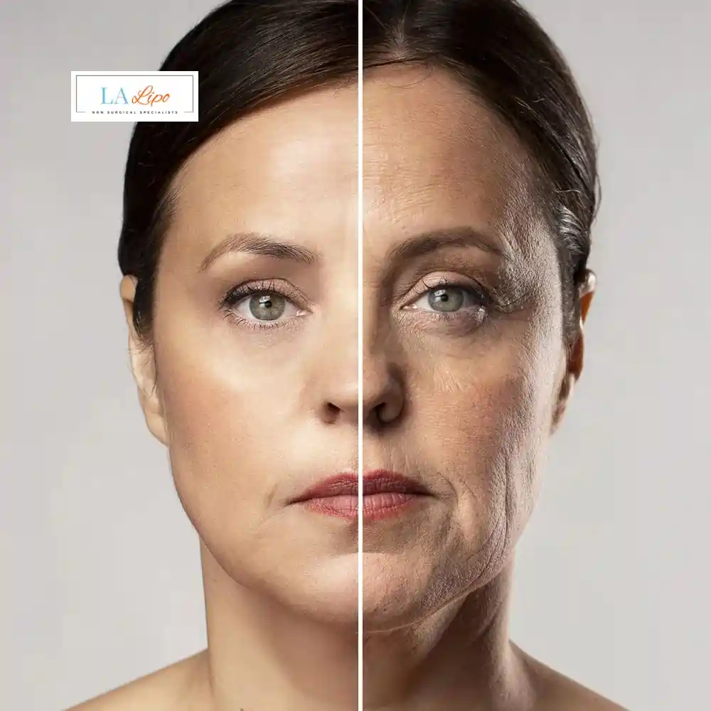 How Can You Tell If Non-Surgical Skin Tightening Is Right for You Fulham?