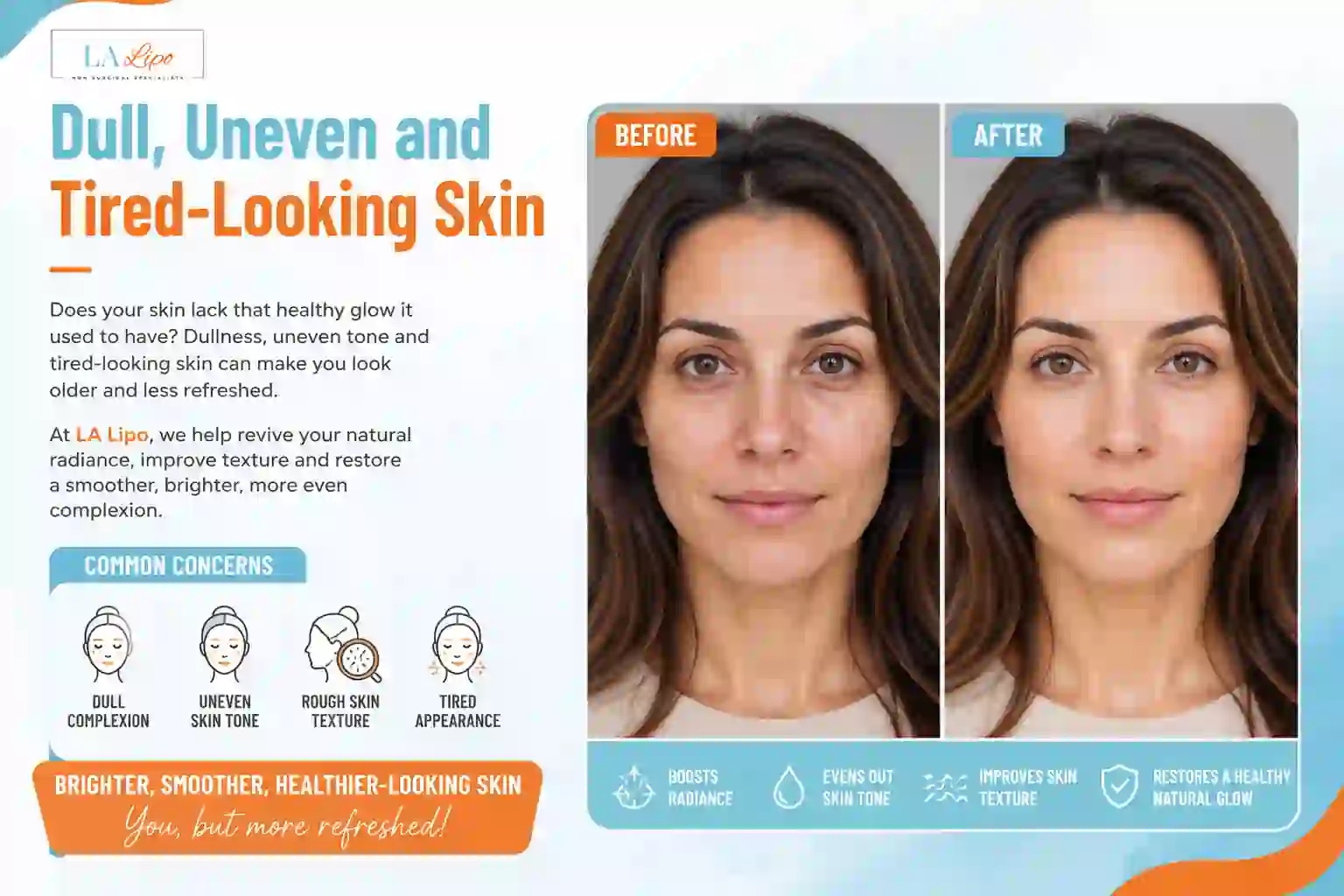 Sign #5: Dull, Uneven and Tired-Looking Skin Fulham