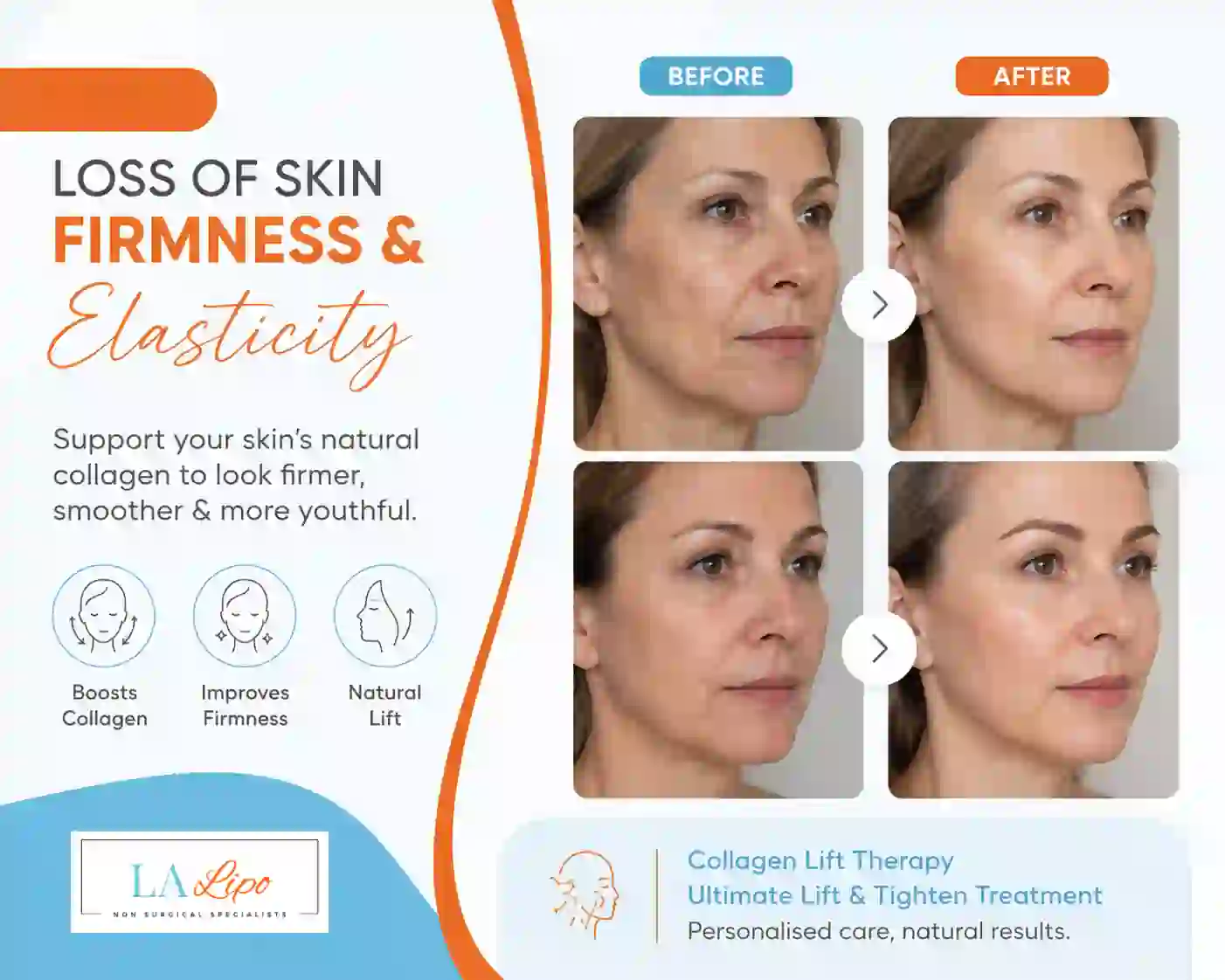 Sign #7: Loss of Skin Firmness and Elasticity Fulham